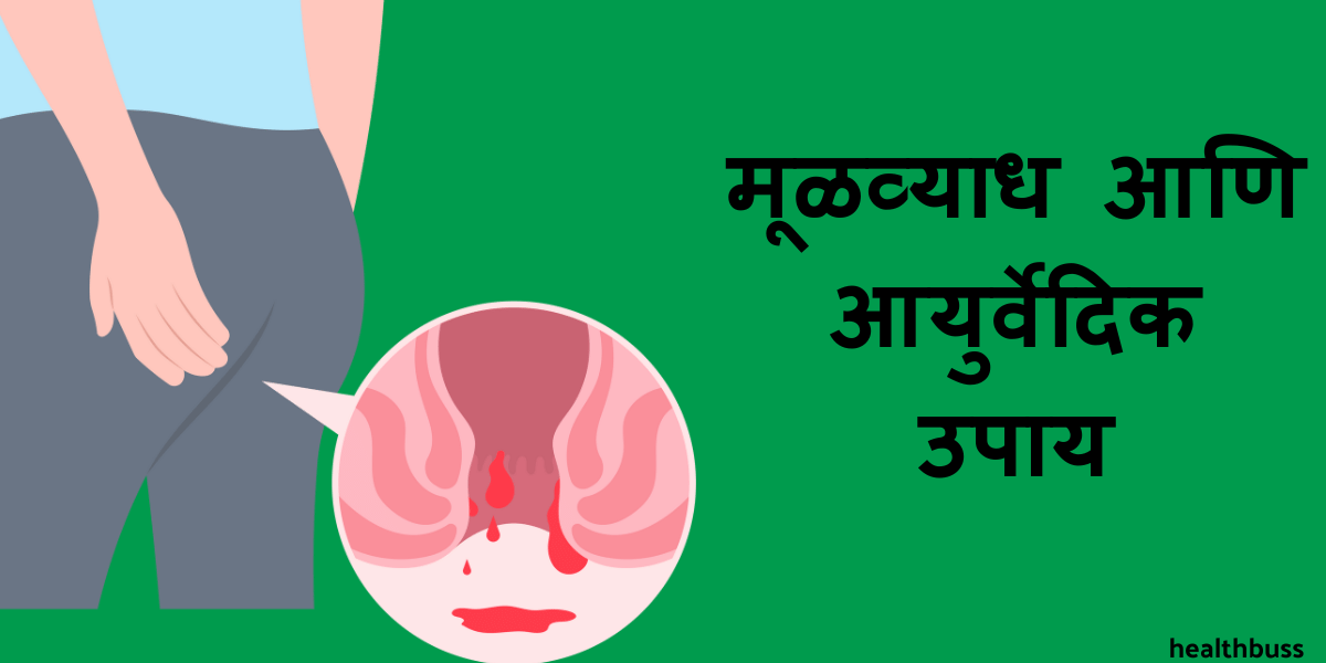 मूळव्याध आयुर्वेदिक उपाय